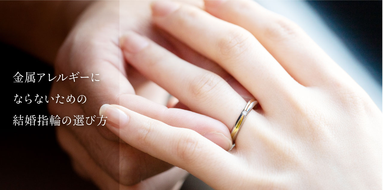 【素材選びが大事！】金属アレルギーにならないための結婚指輪選び